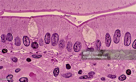 Simple Columnar Epithelium Small Intestine Supporting Connective Tissue High-Res Stock Photo ...