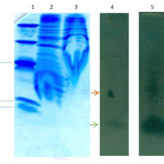 Tricine SDS-PAGE and gel overlay. 1. ultra low range molecular weight ...