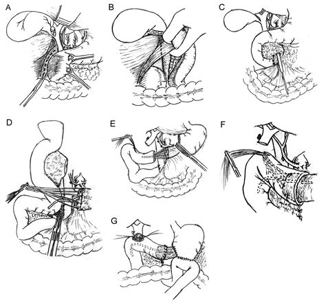 Gastroenterol Res