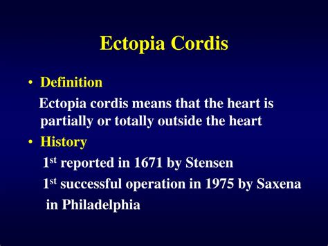 PPT - Ectopia Cordis PowerPoint Presentation, free download - ID:5835842