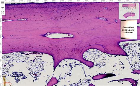 Histology Of Decalcified Bone Cross Section Posters For The Wall | The ...