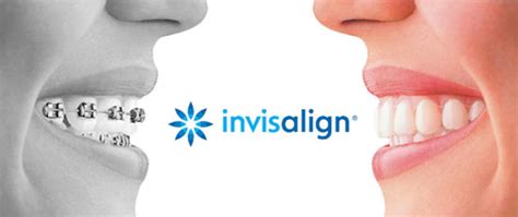 Invisalign in Holly Springs | Klooster Family Dentistry