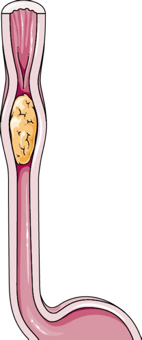 Peristalsis - Servier Medical Art