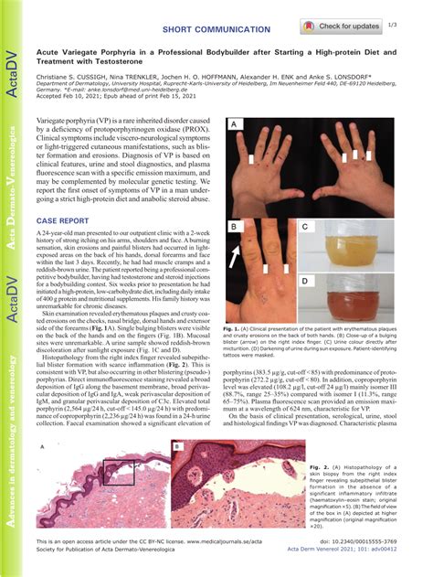 (PDF) Acute Variegate Porphyria in a Professional Bodybuilder after Starting a High-protein Diet ...