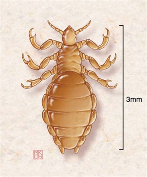 Lice and Scabies: Treatment Update | AAFP