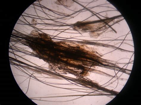 Sebaceous adenitis in dogs | Veterinary Practice