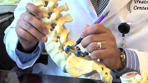 Surgical Procedures - Lumbar Laminectomy & Discectomy - YouTube