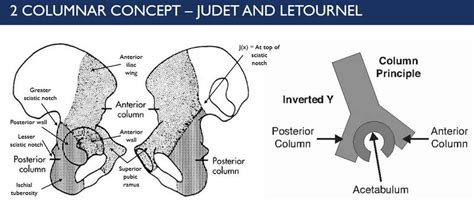 Column Concept of Acetabulum | Epomedicine