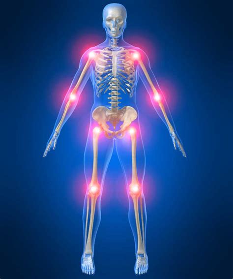 Joint pain and inflammation: Do you need Arthritis Relief? - DivynenHealthy