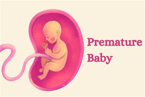 Premature Baby | Symptoms ,causes and Risk Factors | Medintu