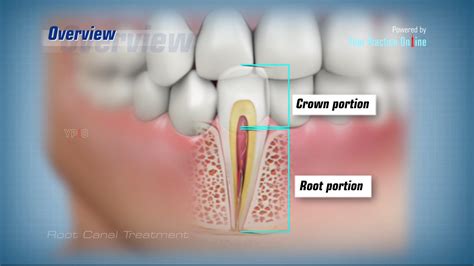 5 Benefits of Root Canal Therapy - UR Health Info