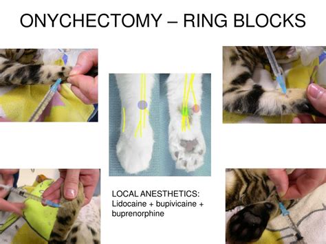 PPT - ONYCHECTOMY PowerPoint Presentation, free download - ID:6652990