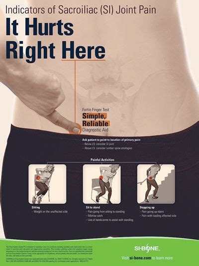 Si joint dysfunction si joint symptoms – Artofit