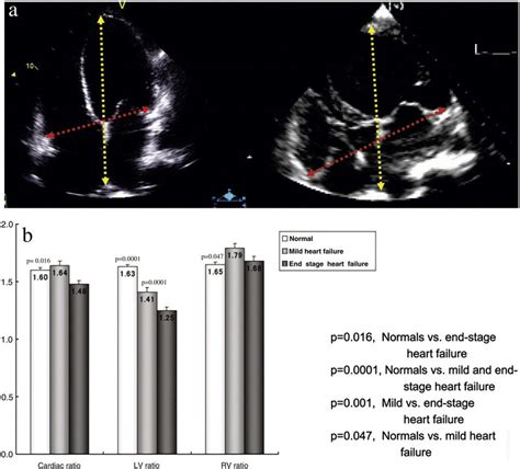 Echocardiograms (a) from 2 patients with heart failure, mild (left) and... | Download Scientific ...