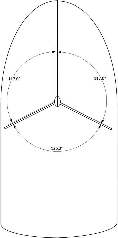 Backstay tension | Sailing Forums, page 1 - Seabreeze