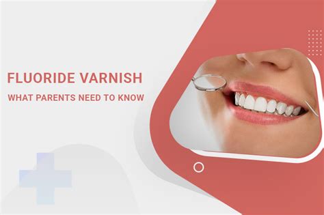 Fluoride Varnish: What Parents Need to Know - Kids Dental Studio