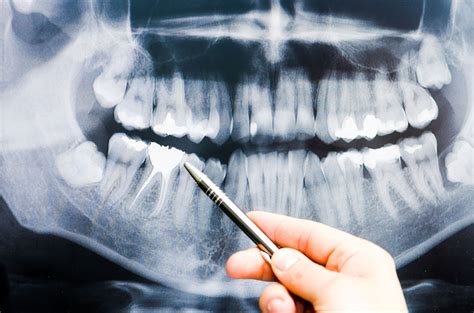 Why does my jaw pop? - Rockefeller Dental Group