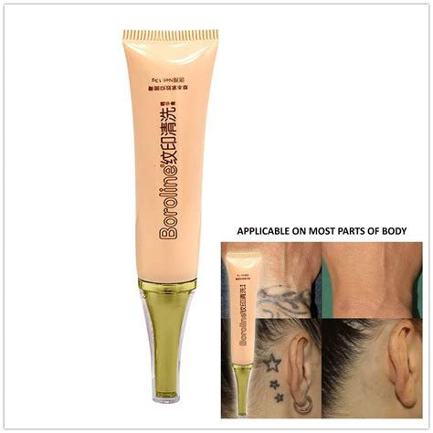 Discover 54+ tattoo removal cream that works latest - in.cdgdbentre