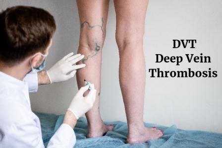 Deep Vein Thrombosis (DVT) Treatments in Pune | Dr. Abhijeet Gotkhinde ...