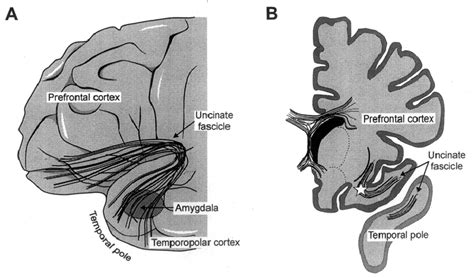 Sketches of the locus of the (ventral) uncinate fascicle and the... | Download Scientific Diagram