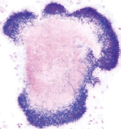 Gram-positive staining of an Actinomyces colony. | Download Scientific ...