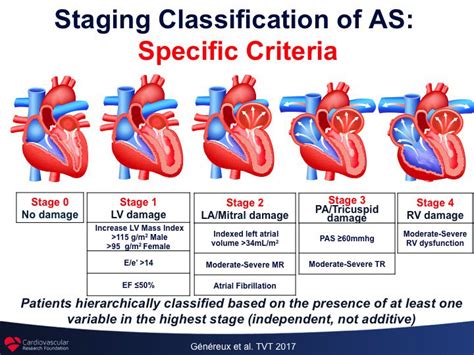 Aortic Stenosis Stages