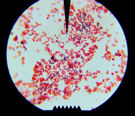 MicrobeDiscoveries: Gram Stain