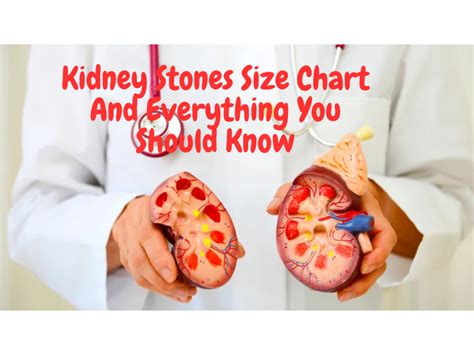 Kidney Stones Size Chart And Everything You Should Know