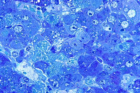 Free picture: photomicrograph, shows, hepatitis, lassa, virus ...