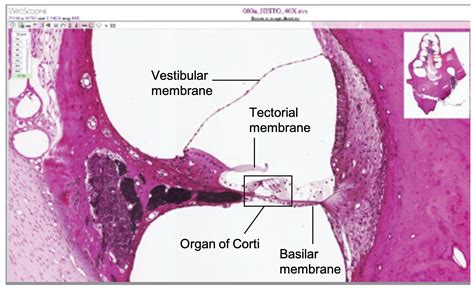 Cochlear Duct Histology