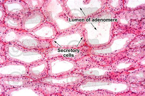 Rabbit. Harderian gland. Vertical section. 125X - Animals - Mammals ...