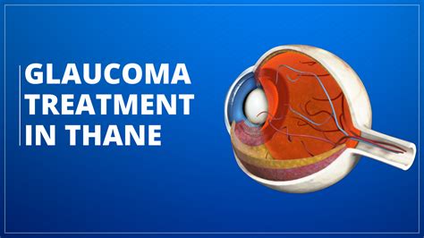 Glaucoma Treatment in Thane | Arora Eye Clinic