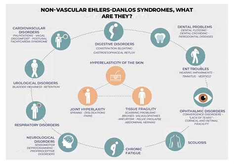 Non-vascular Ehlers-Danlos Syndromes (NV-EDS) - Site internet maladies ...