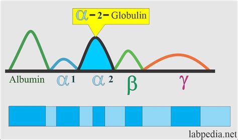 Serum Protein Electrophoresis, Total protein, albumin and globulin - Labpedia.net