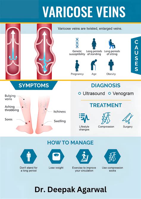 Best Varicose Veins Treatment in Jaipur - AEIRC Clinic, Jaipur