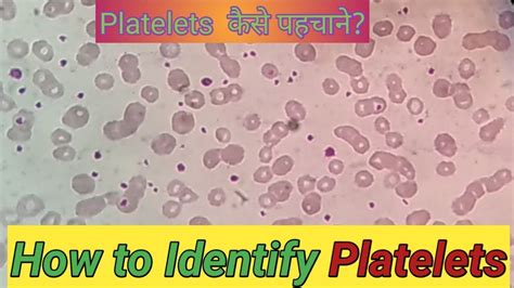 How to identify Platelets count | Platelets under microscope - YouTube