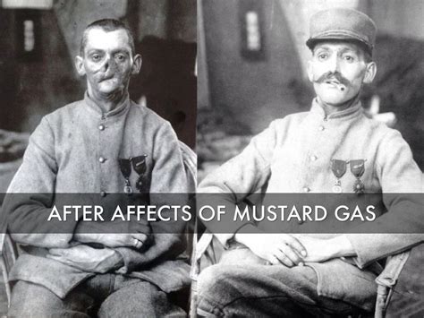 Mustard Gas Ww1 Victims