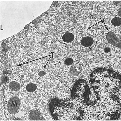 Oxyntic cells from metiamide-treated tissue. Section through a gastric ...