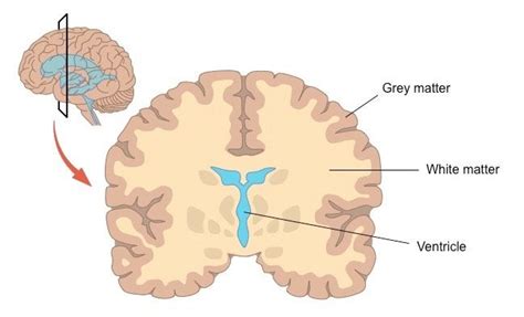 an image of the human brain with labels on each side and arrows ...