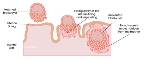 What Is Embryo Implantation And When Does It Occur?, 48% OFF