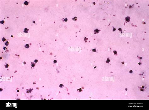 Plasmodium Falciparum Under Microscope