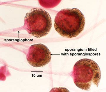 BIOL 230 Lab Manual: Sporangiospores of Rhizopus | Medical laboratory ...