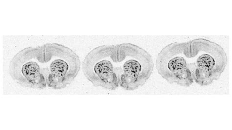 Receptor Autoradiography Assay | Gifford Bioscience