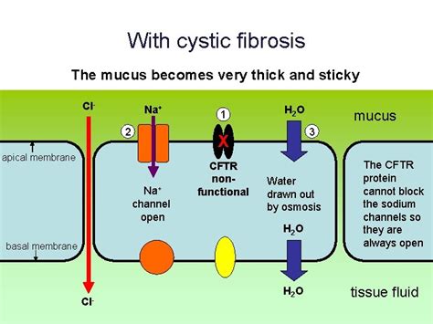 Learning Objectives January 2022 What causes cystic fibrosis