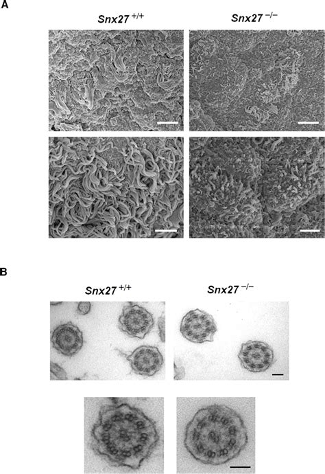 Ciliogenesis is altered in Snx27-deficient mice. A, SEM micrographs of... | Download Scientific ...