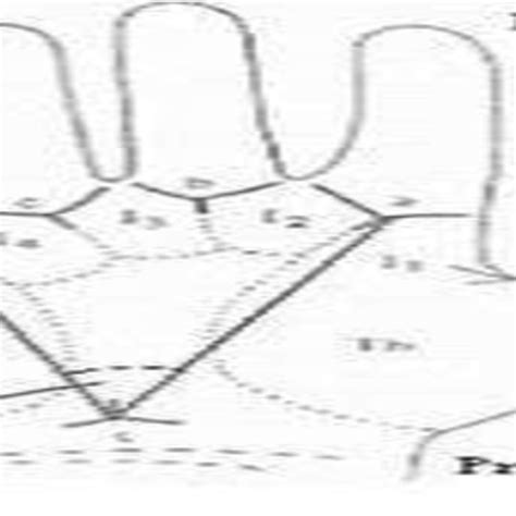 Loop Pattern (a) Radial Loop when found in right hand (Ulnar if in left... | Download Scientific ...