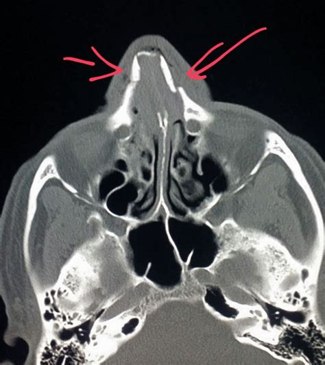 Pin on CT Scans