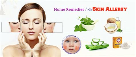 20 Effective Home Remedies For Skin Allergy In Children & Adults