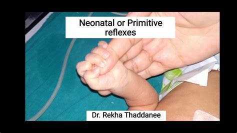 Neonatal Reflex | Palmar Grasp Reflex | Primitive Reflex | Pediatrics - YouTube