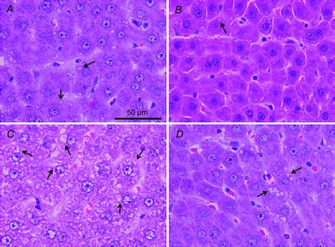 Liver steatosis Representative light micrographs of liver sections ...